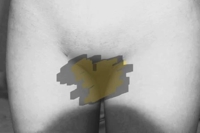 ムズムズしちゃいます