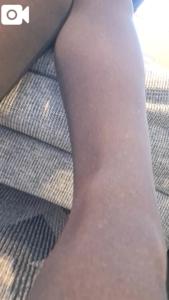 マドンナSANSAIN　百合