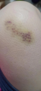 チュパチャップス イクミ