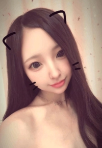 単純細胞