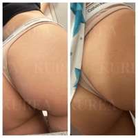Luxury　滝クレア(月下美人)