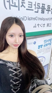 ハーフ疑惑